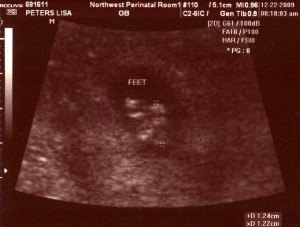The ultrasound tech swears this image shows feet